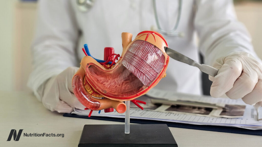 4 the hidden costs of bariatric surgery 1200x675.jpg