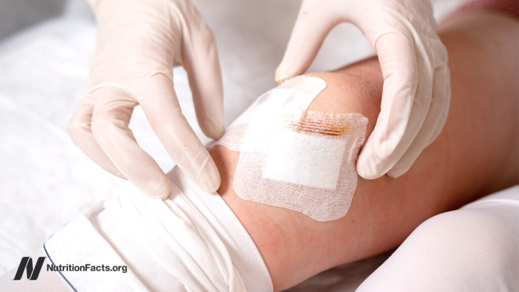 5 from gastric balloons to fake knee surgeries when the fix is an illusion 1200x675.jpg