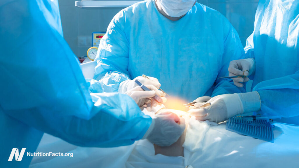 9 bariatric weight loss surgery and mortality 1200x675.jpg