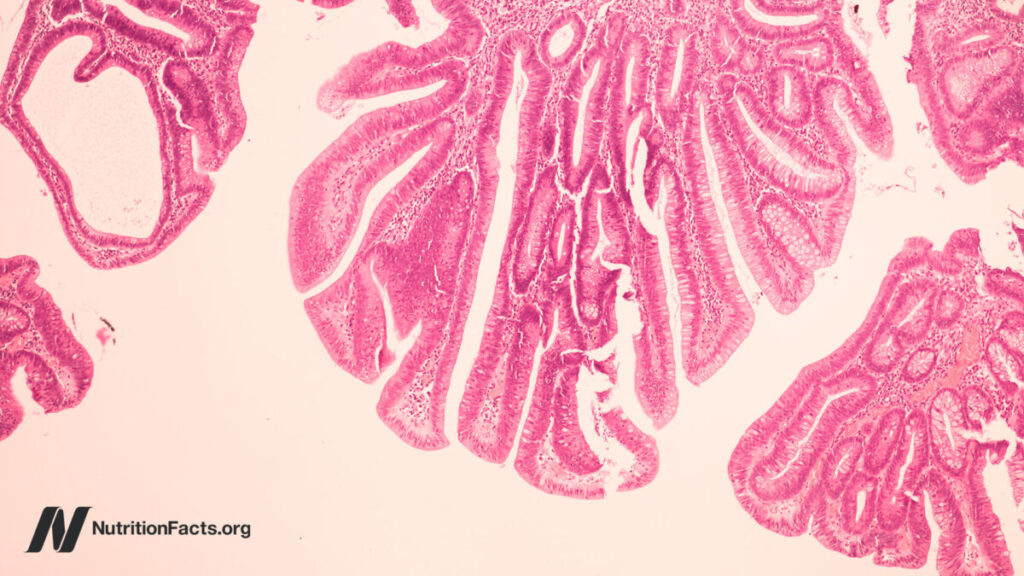 May Bovine Leukemia Virus be a Explanation for Breast Most cancers? 1 could bovine leukemia virus be a cause of breast cancer 1200x675.jpg