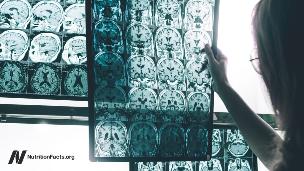 3 a persistent pesticide is linked to alzheimers risk 1200x675.jpg